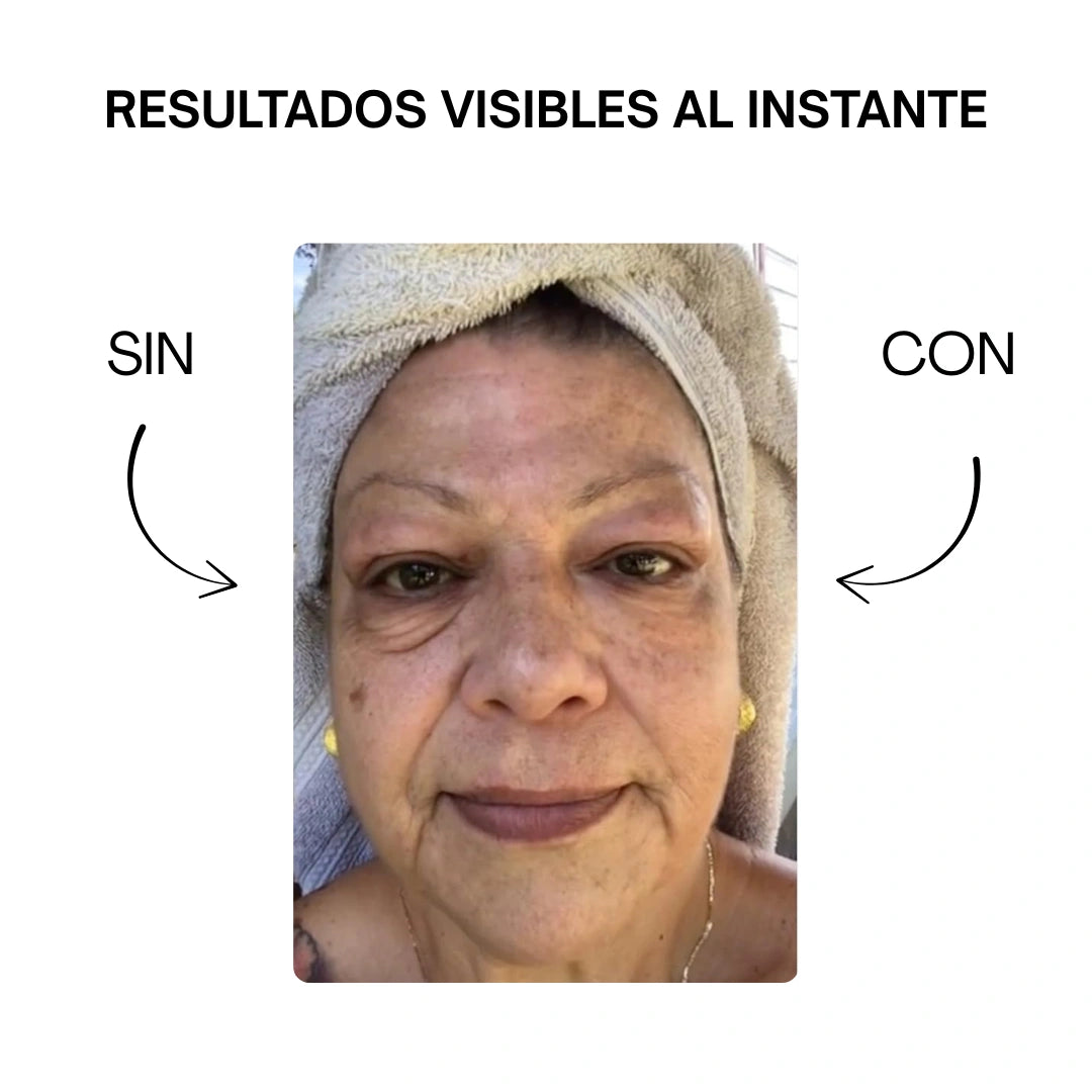 Crema antiarrugas V-Lift