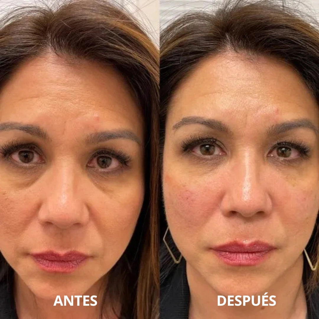 Parches de hidrogel con colágeno y péptidos