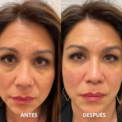 Parches de hidrogel con colágeno y péptidos
