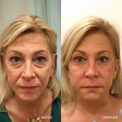 Crema antiarrugas V-Lift