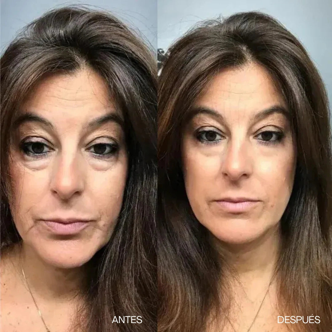 Crema antiarrugas V-Lift